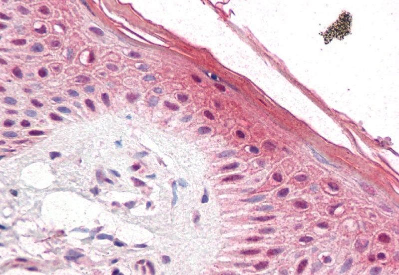 SIAHBP1/FIR Antibody