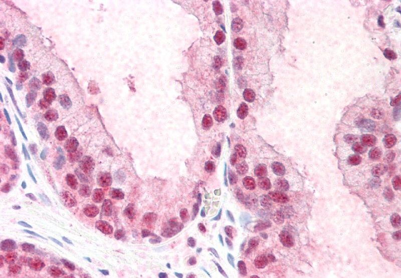 SIAHBP1/FIR Antibody