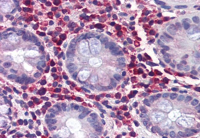 Goat anti-SSA1 / Ro52 Antibody