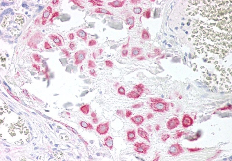 VPS45 (C Terminus) Antibody