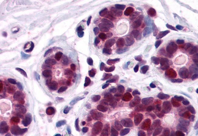 DDX5/p68 RNA helicase Antibody