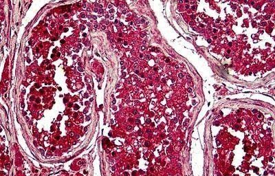 Pituitary tumor-transforming 1/Securin Antibody