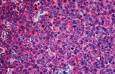 Pituitary tumor-transforming 1/Securin Antibody