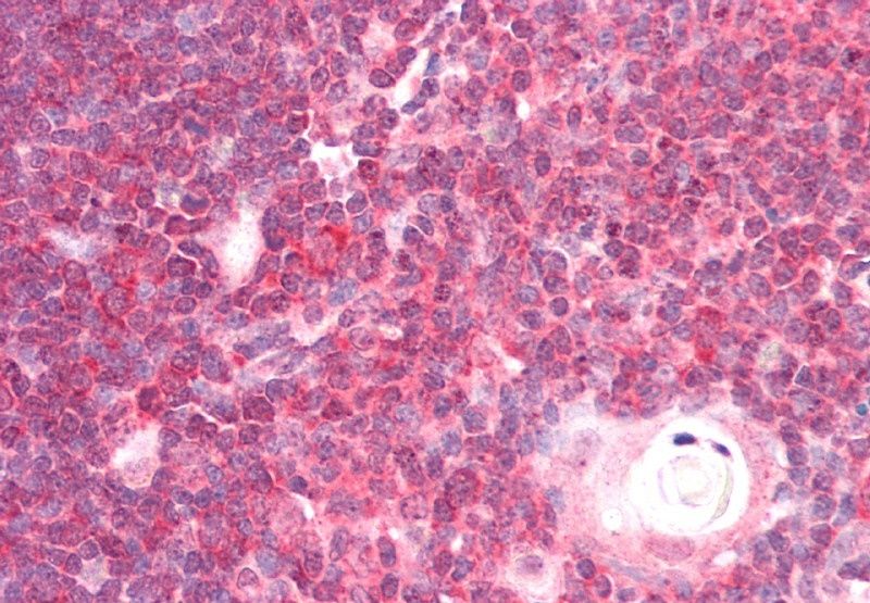 DEAD-box protein 6 Antibody