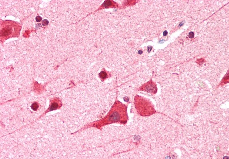 DEAD-box protein 6 Antibody