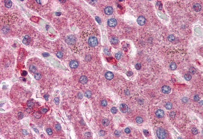 Hyaluronidase 1 Antibody