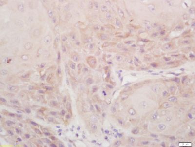 DSPP Rabbit Polyclonal Antibody (HRP)