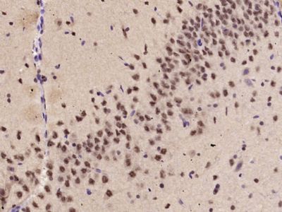 KLF2 Rabbit Polyclonal Antibody (PE)