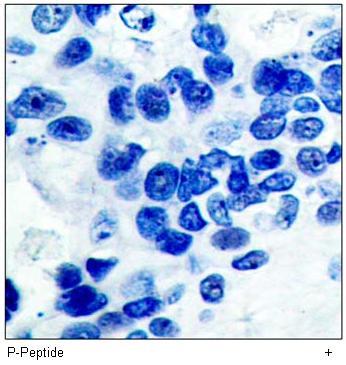 IκB-α (Phospho-Ser32/Ser36) Antibody