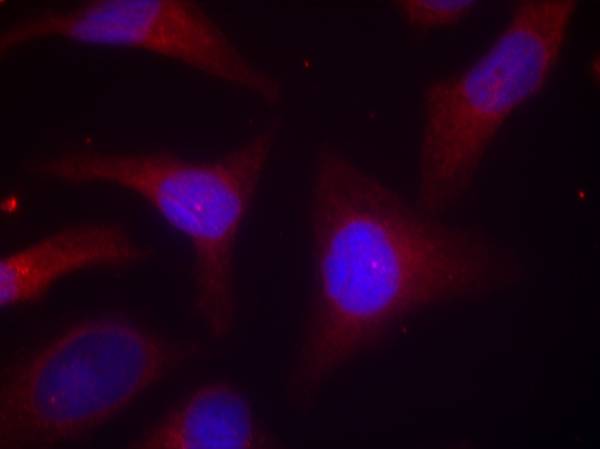 IκB-α (Phospho-Ser32/Ser36) Antibody