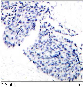 IκB-α (Phospho-Tyr42) Antibody
