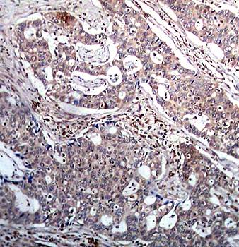 IκB-β (Phospho-Ser23) Antibody