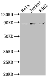 IKBKB Antibody