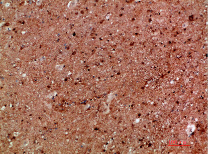 IKBKG Antibody