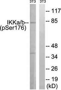 IKK-α (Phospho-Ser176) /IKK-β (Phospho-Ser177) Antibody