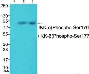 IKK-α (Phospho-Ser176) /IKK-β (Phospho-Ser177) Antibody