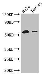 IKZF1 Antibody