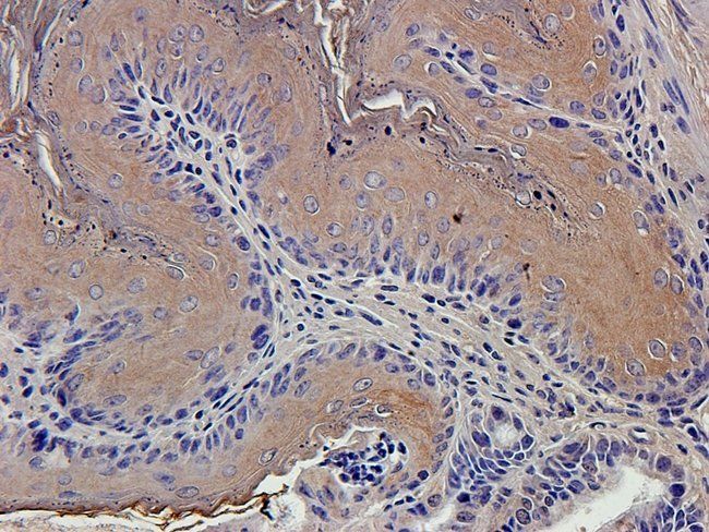 IL1 beta Rabbit Polyclonal Antibody