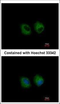 IL1 Receptor 2 Rabbit Polyclonal Antibody