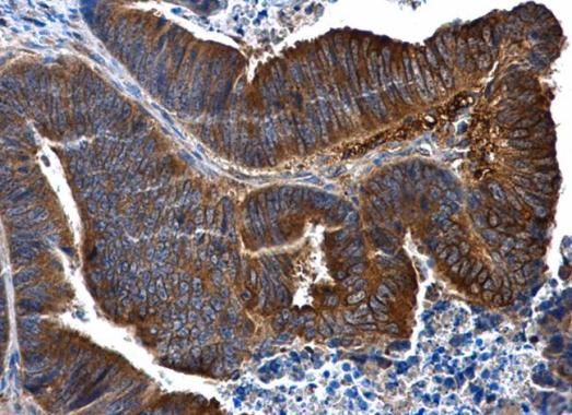 IL1 Receptor 2 Rabbit Polyclonal Antibody