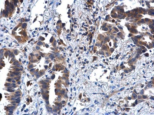IL1 Receptor 2 Rabbit Polyclonal Antibody