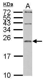 IL1 Receptor antagonist antibody
