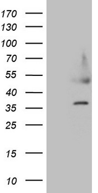 IL12RB1 Antibody