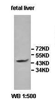 IL13RA2 Rabbit Polyclonal Antibody
