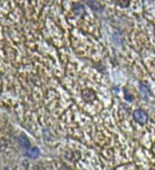 IL13RA2 Rabbit Polyclonal Antibody