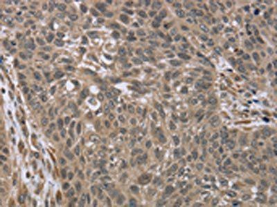 IL15RA Antibody