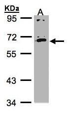 mesothelin Antibody