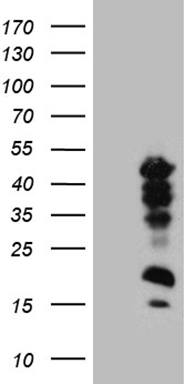 IL17B Antibody