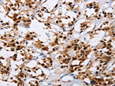 IL17C Antibody