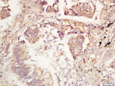 IL17E Rabbit Polyclonal Antibody (FITC)