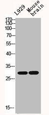 IL1B Antibody