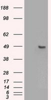 IL2 Receptor beta Antibody