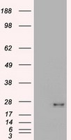 IL2 Receptor beta Antibody