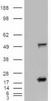 IL2 Receptor beta Antibody