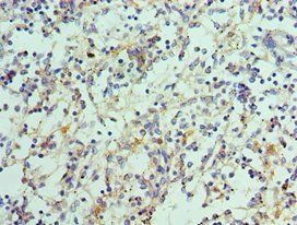 IL21 Antibody
