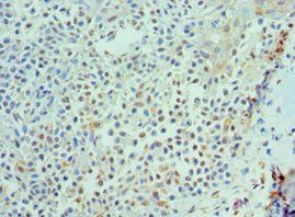 IL21 Antibody