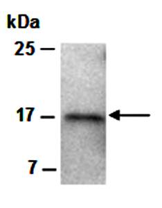 IL21 (vPairTM) Antibodies