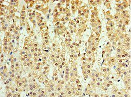 IL25 Antibody