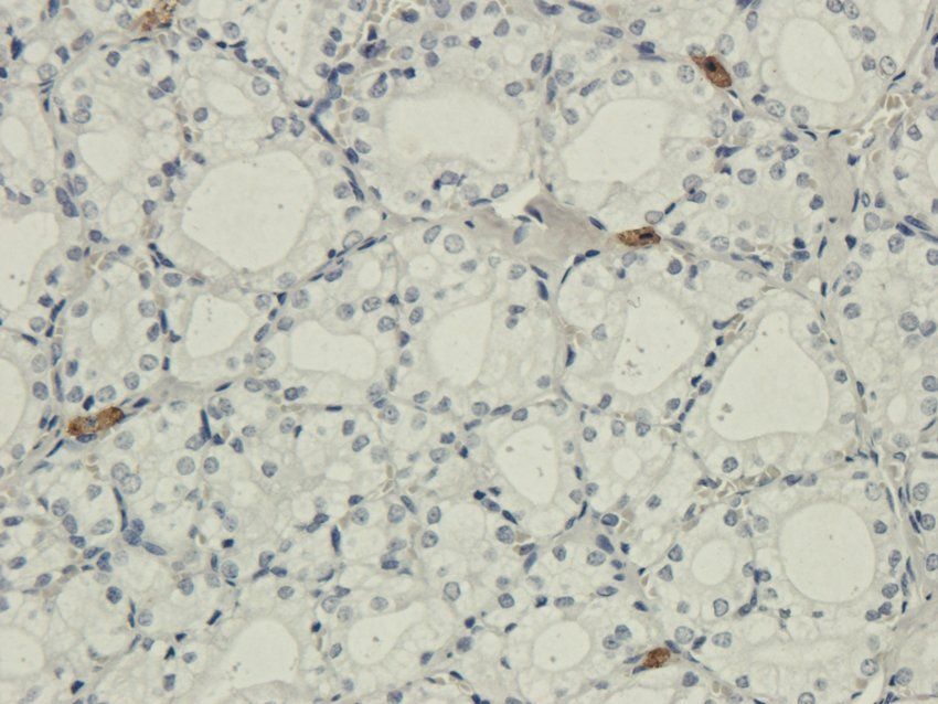 IL26 antibody