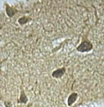IL29 Rabbit Polyclonal Antibody