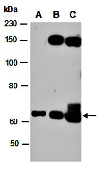 IL2RB (C) Antibody, Rabbit Polyclonal