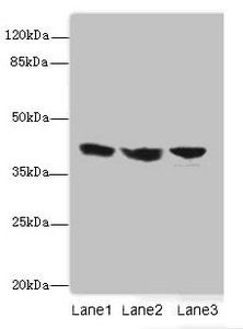 IL2RG Antibody