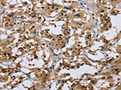 IL31 Antibody