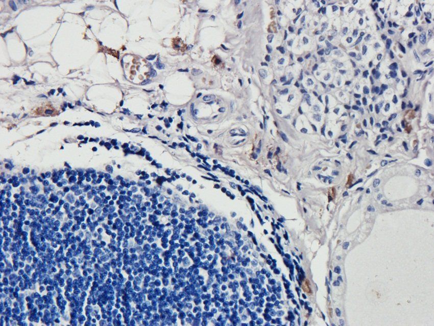 IL36 gamma Rabbit Polyclonal Antibody