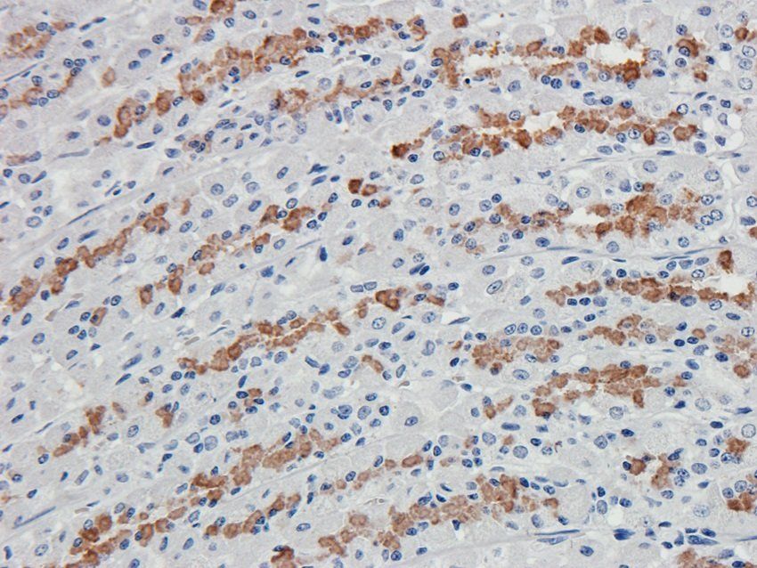 IL36 gamma Rabbit Polyclonal Antibody