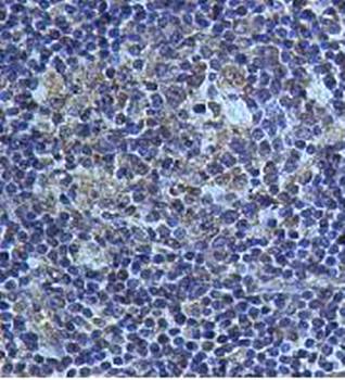 IL3 Rabbit Polyclonal Antibody